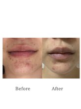 サロン リノ(salon rino)/