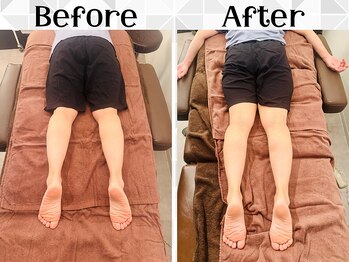 リストアハート(Restore Heart)/骨盤矯正