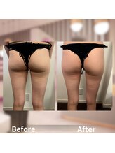 アムール 麻布十番(Amour)/人気のエンダモロジー専門店