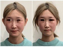 リシュレータ(RISYURE-TA)/