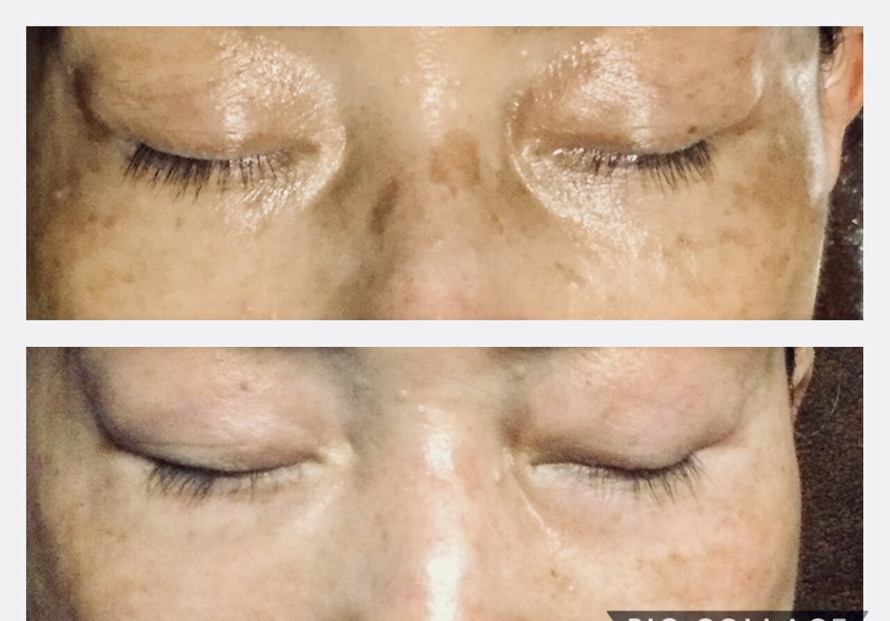 ドクターピュールボーテ　#6 Dr.PUR BEAUTE（ドクター・ピュールボーテ）福岡校 | ドクター