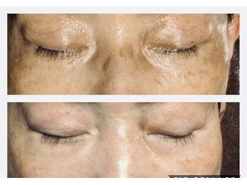 ドクターピュールボーテ 神戸店(Dr. PUR BEAUTE)