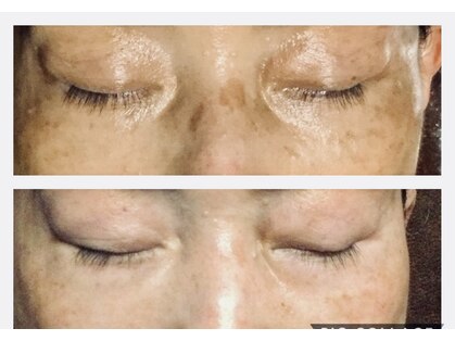 ドクターピュールボーテ 神戸店(Dr. PUR BEAUTE)の写真