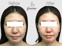 ゲントツ 新宿の雰囲気（圧倒的小顔[小顔/毛穴/フェイシャル］）