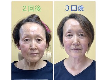 チュベルフェ(tu belle fe)/ギノーVAR