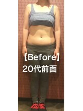 24ダイヤモンドジム(24 DIAMOND GYM)/【Before】30代女性前面