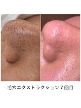 シェソワ(Chez soi)/頑固な黒ずみもここまでキレイに