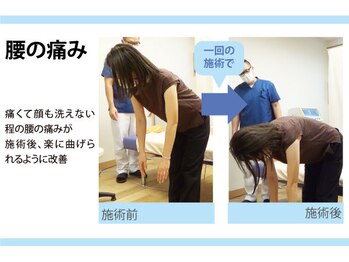 セルフケア整体 新宿店/実際のお客様◆1来店 腰痛