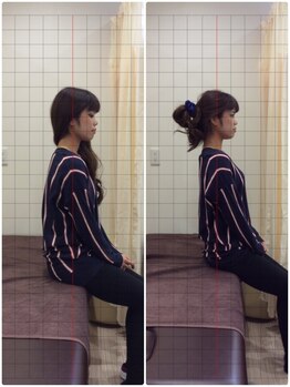 みのお骨盤リフォーム整骨院/猫背before after