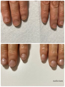 ネイルズシアム/深爪矯正　デザインネイル