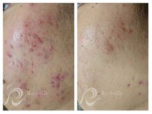 パルファンカルム 駅西本町店/お客様リピート率９０％の理由。