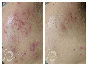 パルファンカルム 駅西本町店/お客様リピート率90%の理由。