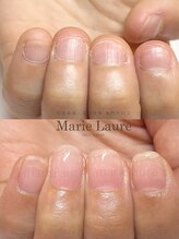 マリーロール 淀屋橋本店(Marie Laure)/自爪育成/深爪矯正/ネイルケア