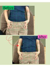 楽する鍼灸 整骨院 南福岡院/