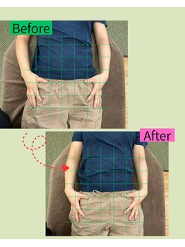 楽する鍼灸 整骨院 南福岡院/