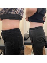 ナオ接骨院(NAO接骨院)/Before／After