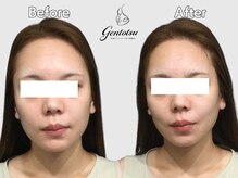 ゲントツ 新宿の雰囲気（究極の小顔[小顔/毛穴/フェイシャル］）