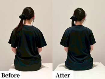 ソレア(Solea)/肩こり・身体の歪み改善1回目