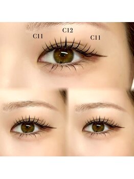 ララディーテ 昭和店(LARAdite)の写真/初めての方大歓迎!丁寧なカウンセリングでモチの良さを実現する理想のサロン◎