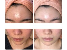 オアジスパ(Oasi Spa)/