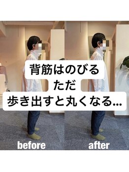 カワル整体 上通り院/歩くと背中が丸くなってしまう