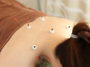 久心宝鍼灸院/妊活の鍼