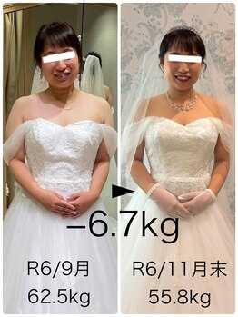 ハッチー(Hacchi)/【20代】ブライダル痩身！