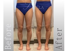 ステラ(STELLA)/下半身スタンダードの効果