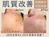 【夏肌リセット間に合うのは今だけ】シミ、シワ作らない！増やさない！初回