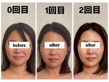 キプラ 福津店(KIPURA)/1回目より2回目　別人級？