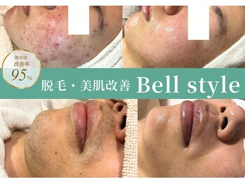 ベルスタイル(Bell style)