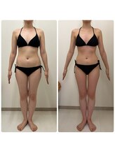 アミクール エステティックサロン(amicoeur)/