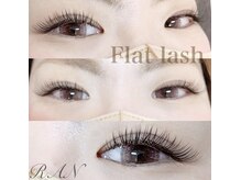 ラン(RAN)/フラットラッシュ