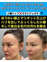 スペチアーレ 夙川/たるみ改善、毛穴引き締めに♪