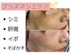 ルーム(room)の写真