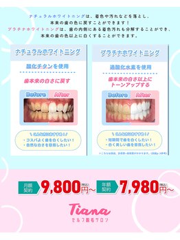 ティアナ 神栖店(Tiana)/ナチュラル、プラチナ比較