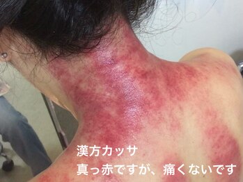 Hb 与野/漢方カッサ（むくみ、冷え改善）