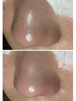 フラリス(fraris)/