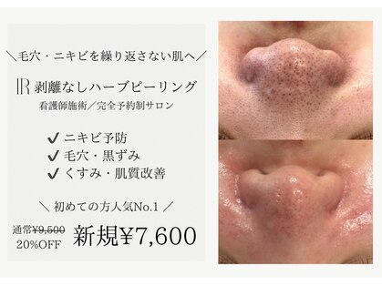 アイアール(ir)の写真