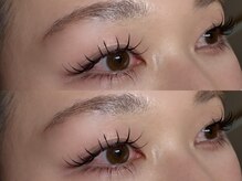 エトルナ(etoluna)/パリエク100本