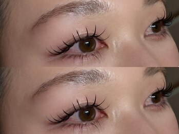 エトルナ(etoluna)/パリエク100本