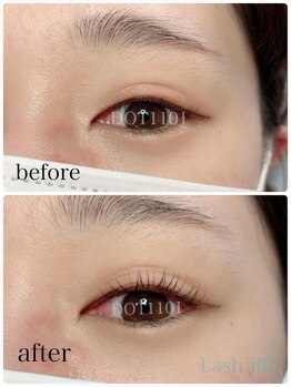 ドットイチイチマルイチ 銀座店(DOT1101)/ラッシュリフト