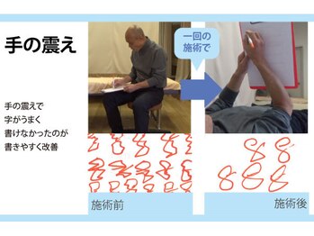 セルフケア整体 新宿店/実際のお客様◆1来店 手の震え
