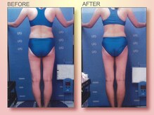 ジュリア オージェ 天王寺店/ビフォーアフター（脂肪燃焼）