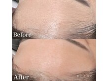 ブラン 磐田店(Blanc)/おでこWAX