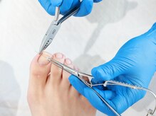 ドクターネイル爪革命 小田原鴨宮店の雰囲気（巻き爪・爪の形のお悩みは、お任せ下さい！）