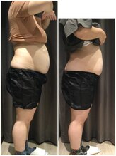 アイスタイル(i-style)/脂肪冷却/痩身ダイエット/泉大津