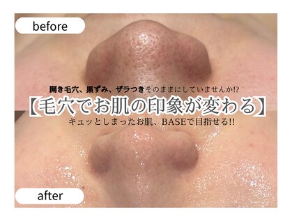 ベース(BASE)の写真