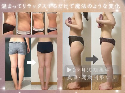 ヨサパーク ペアセント(YOSA PARK pearscent)の写真