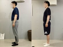 イレ 名古屋栄(ile)/ストレートネックが5回で変わる